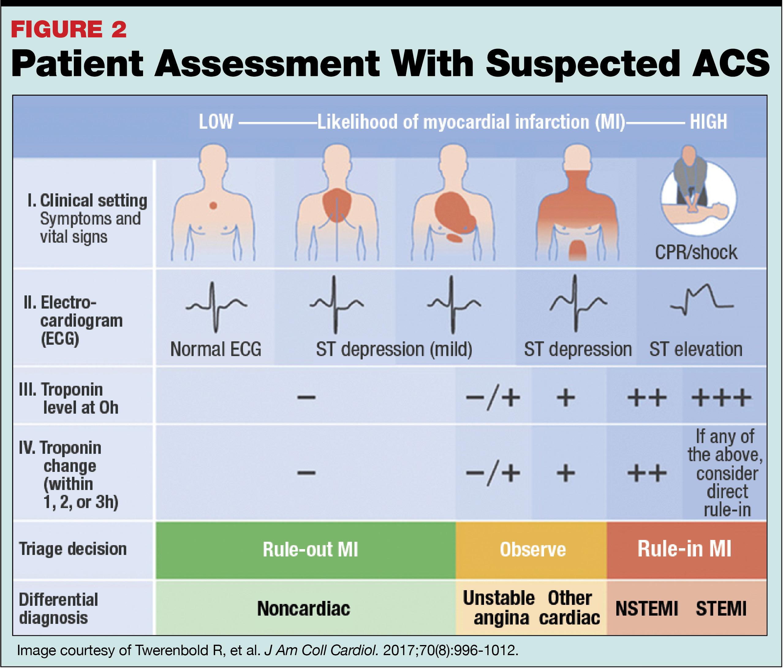 Normal troponin levels: Healthy ranges and what high levels mean