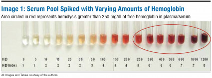 6 point test sugar blood Reducing Pneumatic Tube Induced Hemolysis in Blood 6 point test sugar blood Reducing Pneumatic Tube Induced Hemolysis in Blood